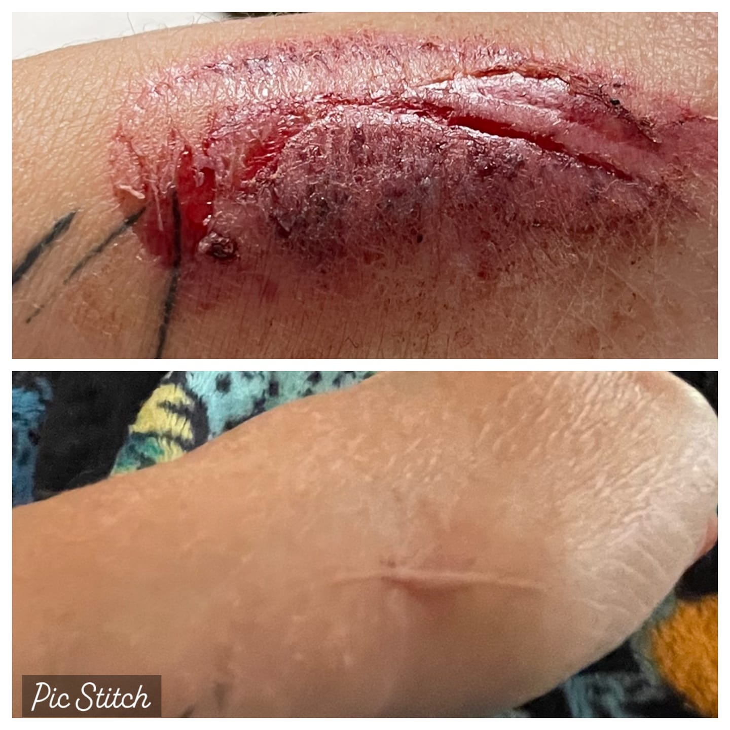 Customer photo review of Combat Ready Ointment - Mother of All Bottles (MOAB)