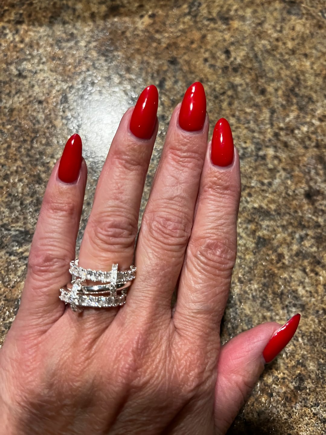 Customer photo review of Quintuplet Ring