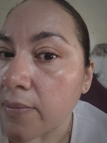 Customer photo review of Tónico Facial con Agua de Rosas + Vitamina B5 + Niacinamida - Sin Fragancia - Sin Alcohol Etílico - 97% Ingredientes Naturales - 350ml