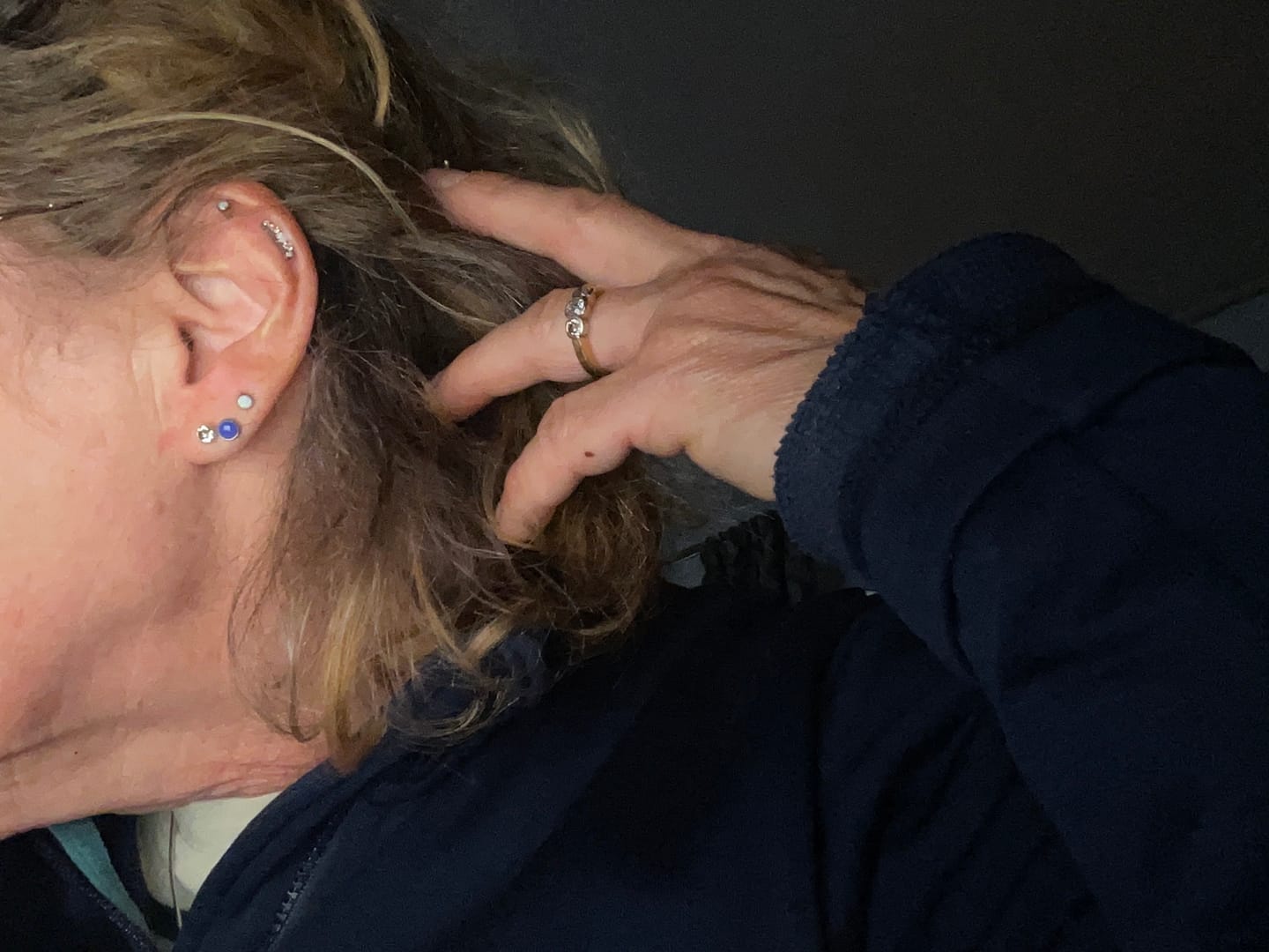 Customer photo review of Junipurr Titanium Flatback Labret Threadless