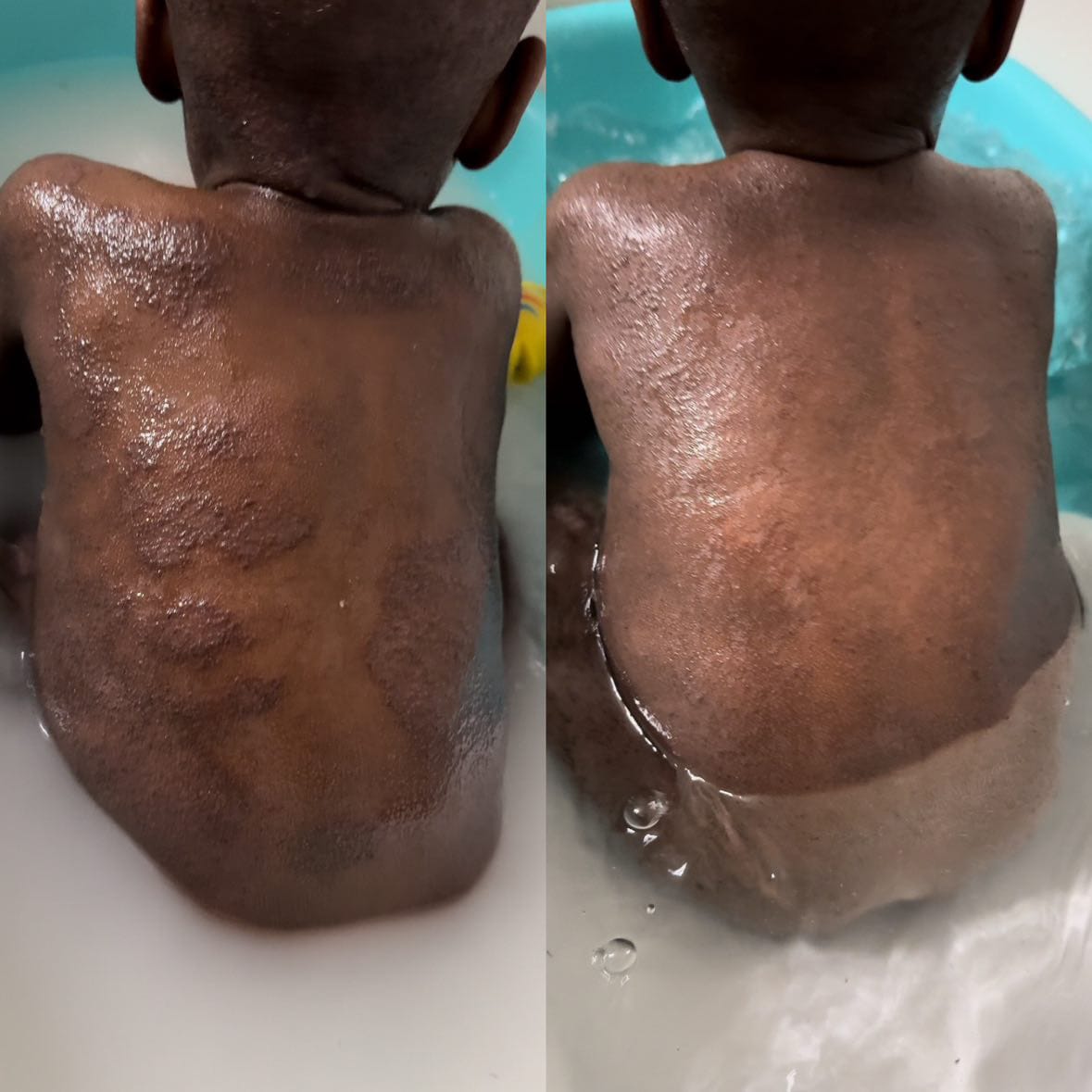 Customer photo review of Children’s Gut Rebalance Kit