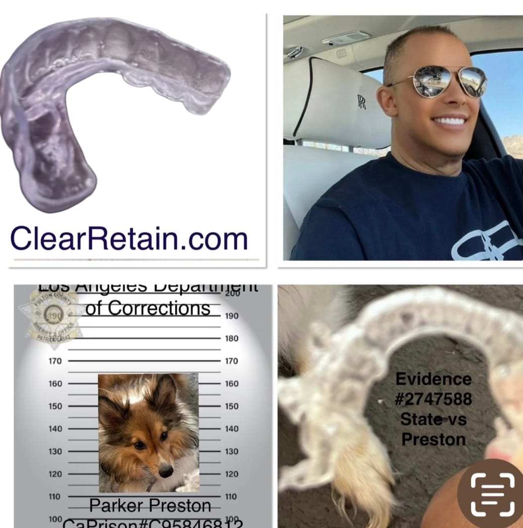 Customer photo review of REORDER-Lower Soft Night Guard