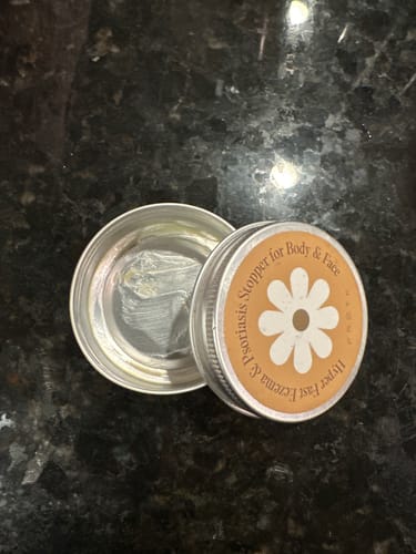 Customer photo review of Ultra-Fast Relief Balm for Dry, Itchy Skin – For Body & Face