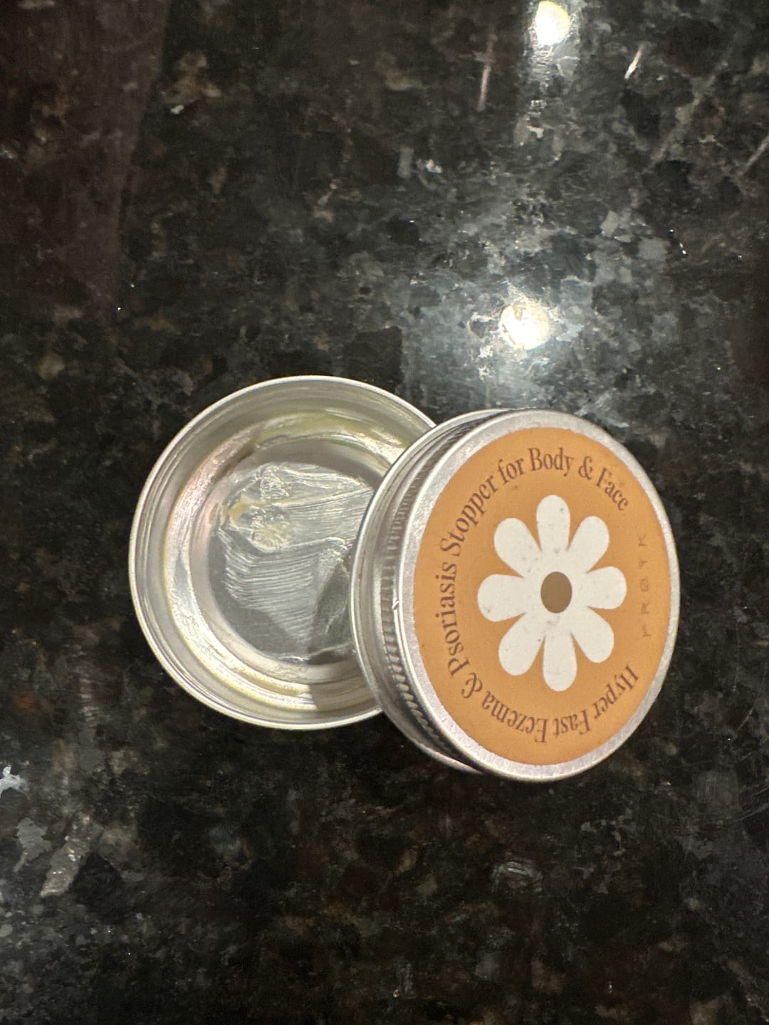 Customer photo review of Ultra-Fast Relief Balm for Dry, Itchy Skin – For Body & Face