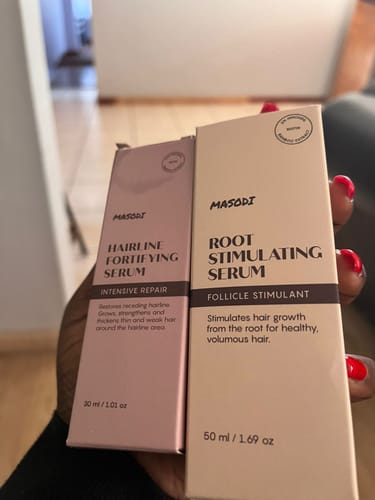 Customer photo review of Hairline Fortifying Serum 30ml