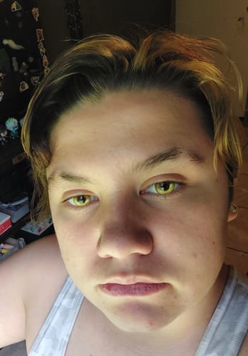 Customer photo review of Cosplay Anime Yellow Prescription Colored Contact Lenses