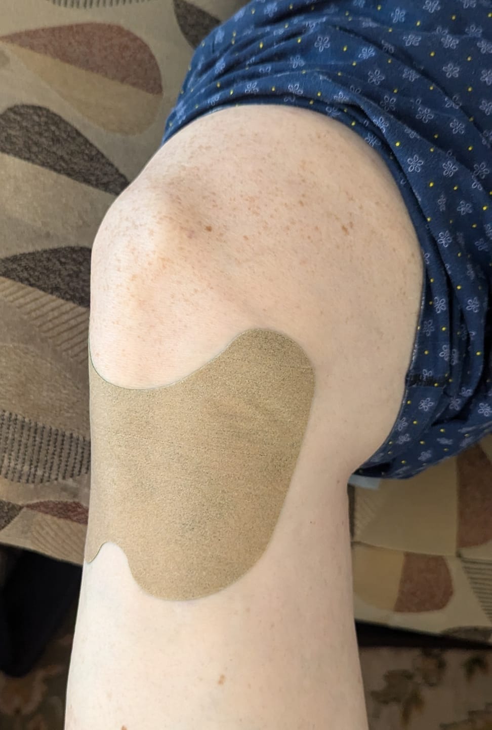 Customer photo review of Auxillium Knee Patch (fka Heaven Patch)
