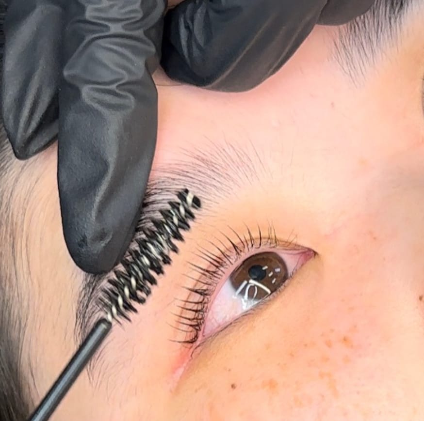 Customer photo review of Glue-Free Flexi Shields