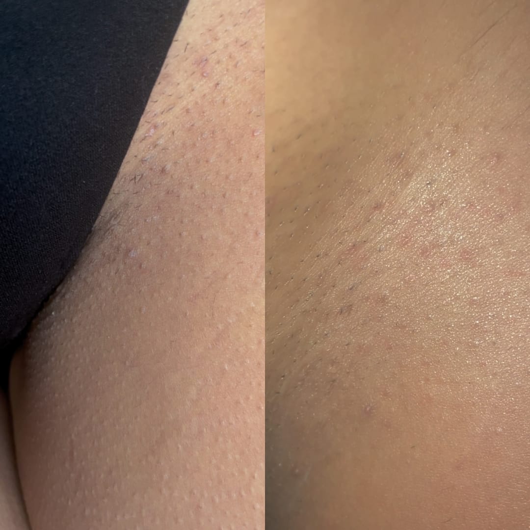 Customer photo review of Intimate Scrub
