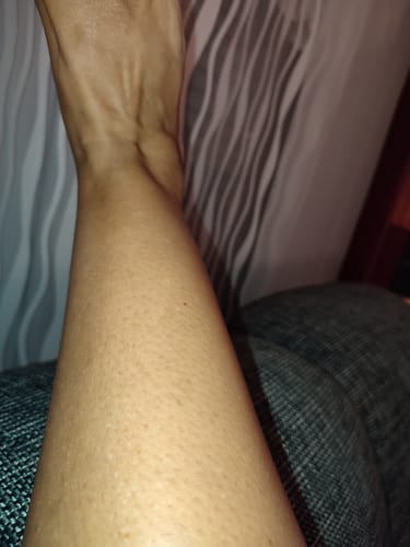 Customer photo review of 5x Belle Body Haarentfernung