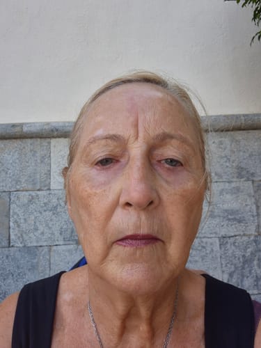 Customer photo review of Pack Firmeza Total