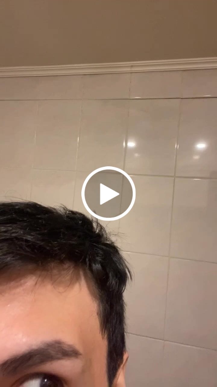 Customer video review of Kit Anticaída  Shampoo en barra y Tónico
