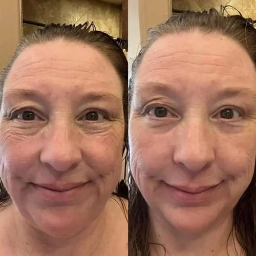 Customer photo review of Crème Anti Cernes et Rides Instantanée