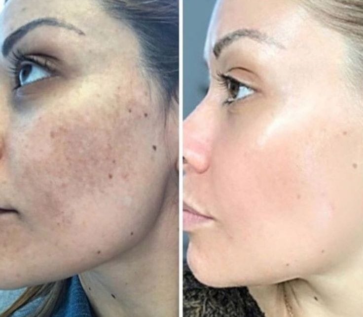 Customer photo review of Ultra Whitening Serum