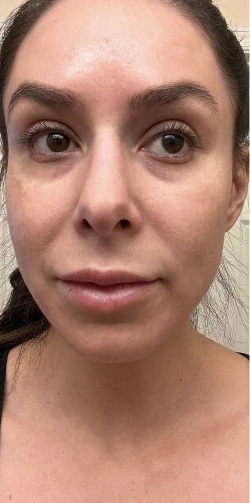 Customer photo review of Under Eye Skincare Wand