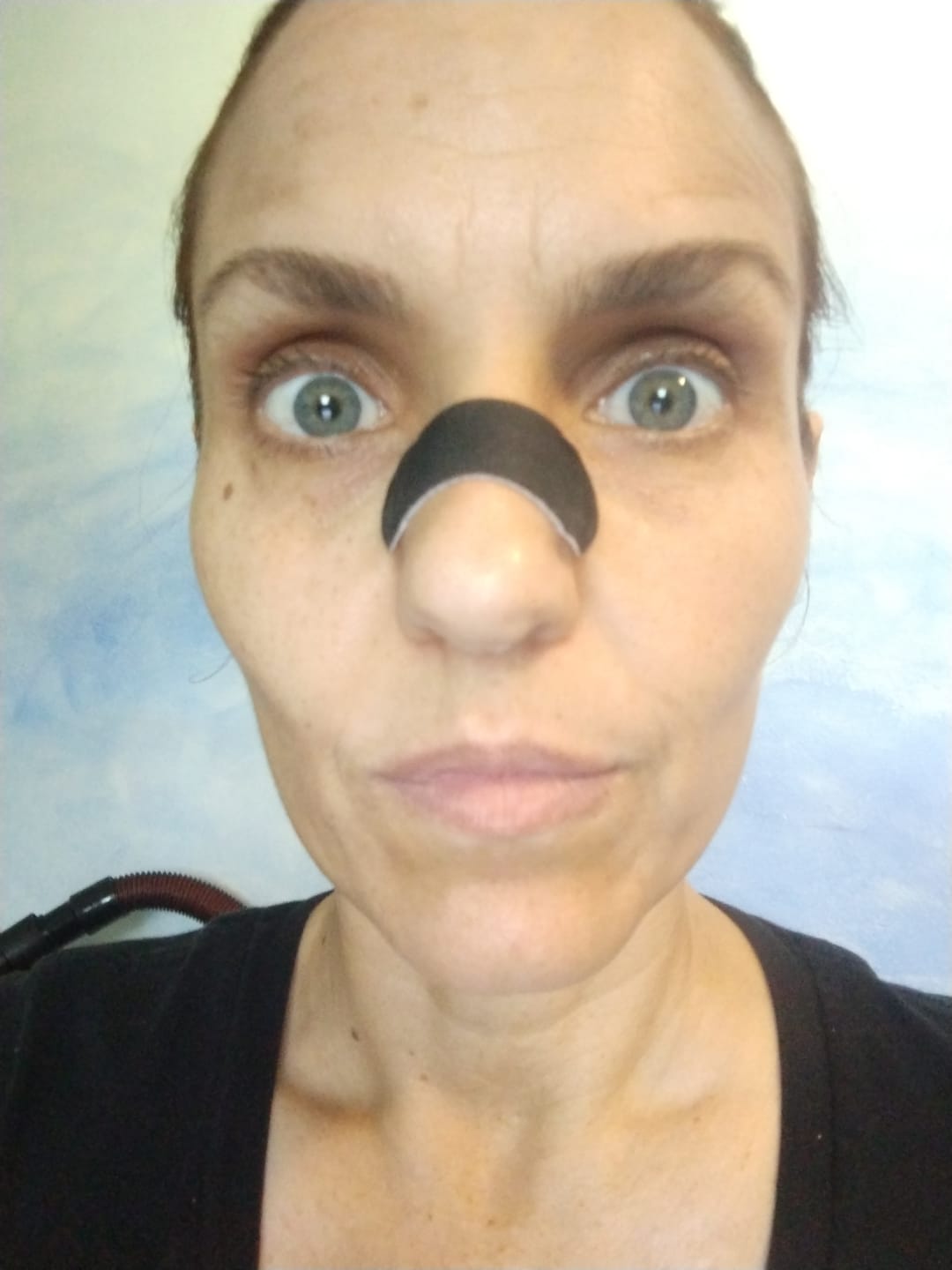 Customer photo review of Hostage Nose Strips