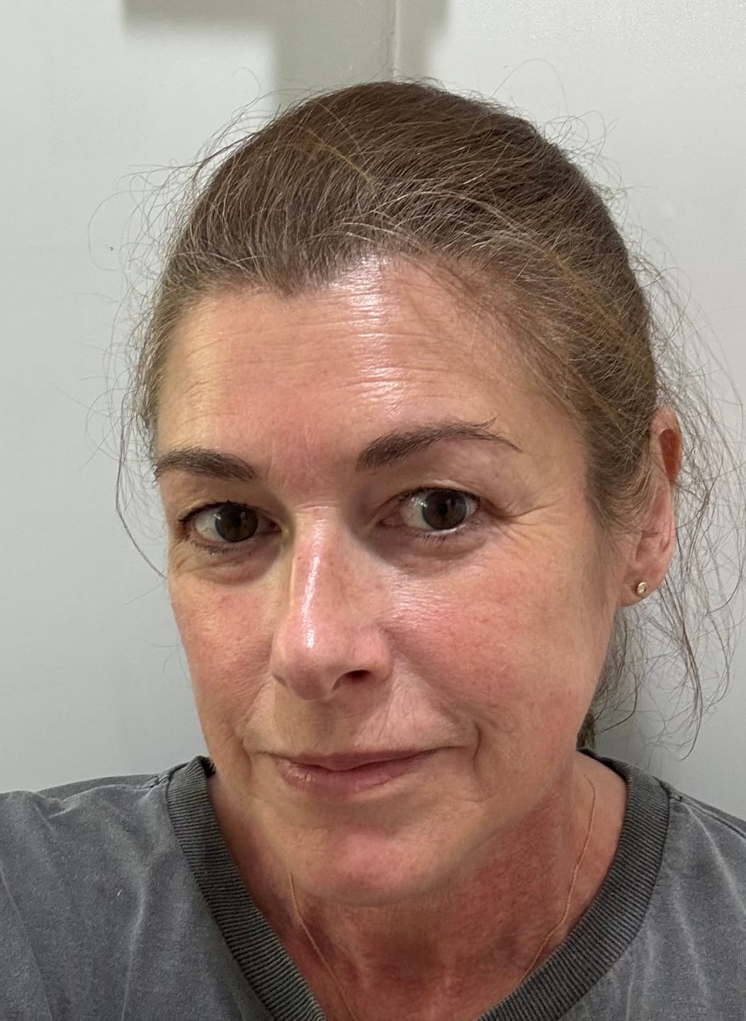 Customer photo review of Ageless AHA Glow Concentrate