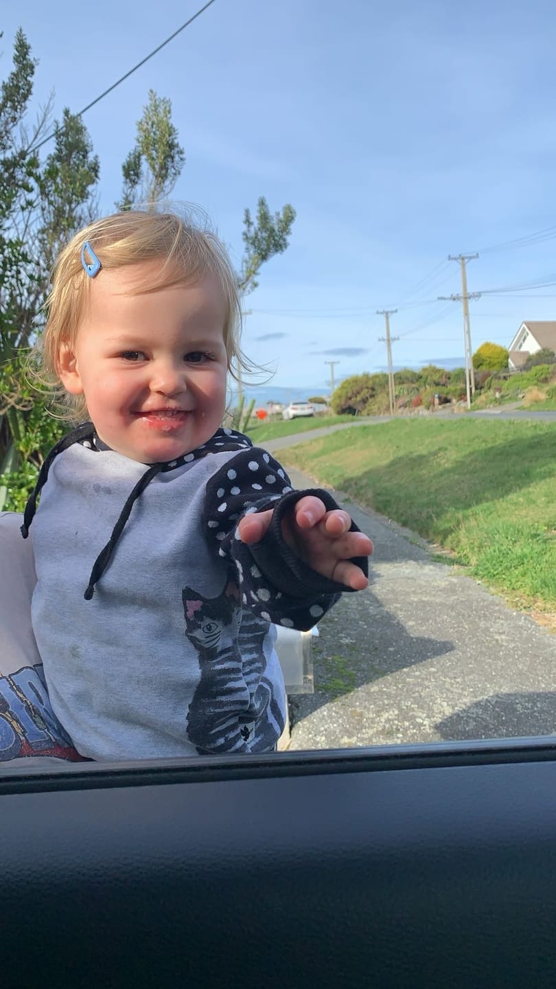 Customer photo review of Kawakawa Repair Balm - Winner, Best SOS/Healing Balm 2024