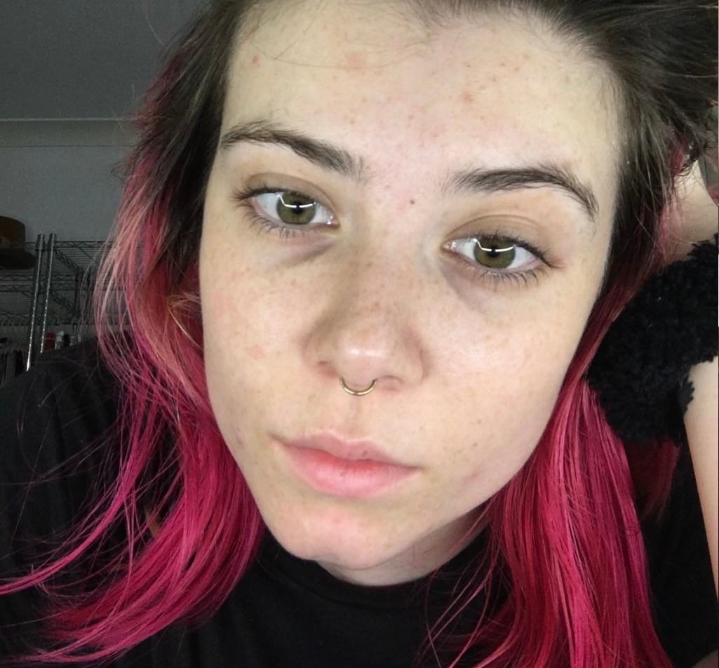 Customer photo review of Under Eye Skincare Wand