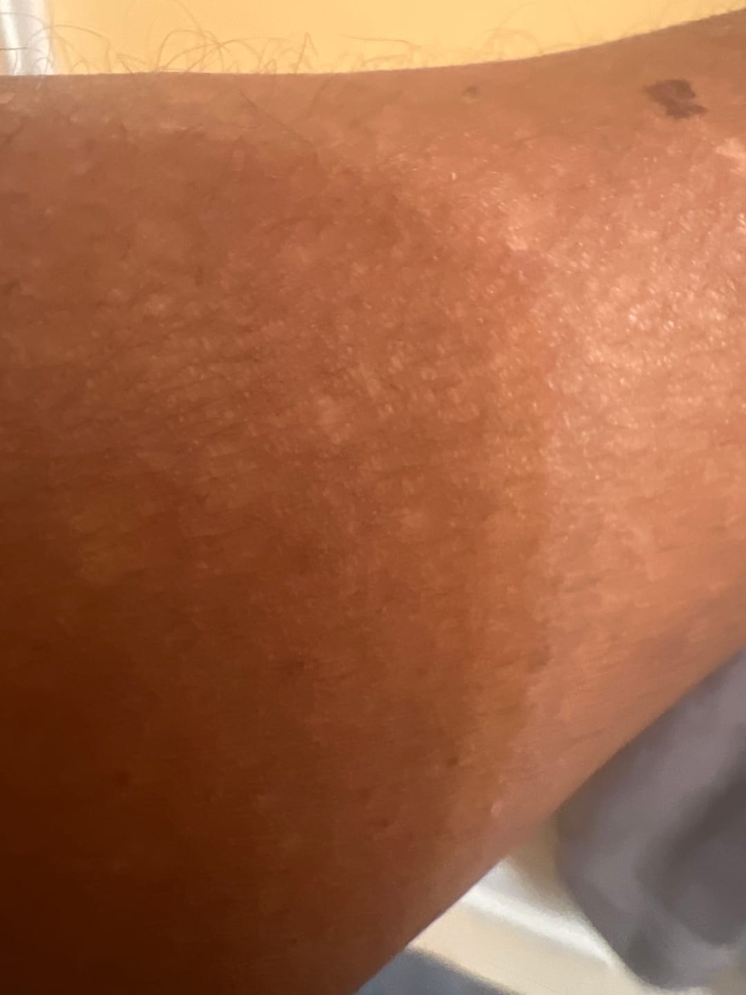 Customer photo review of Fair and White Original Glutathion Extra Brightening Lotion 500ml / 16.90 fl oz