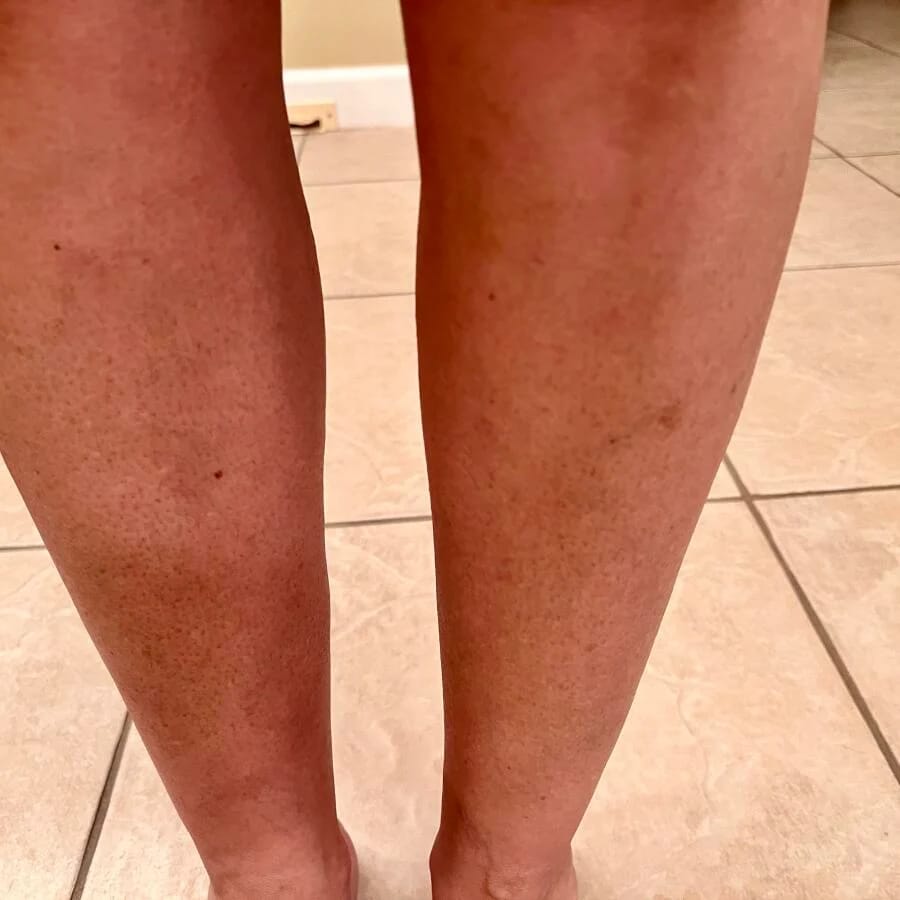 Customer photo review of SkinUp Clásica