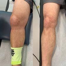 Customer photo review of 【Official Brand Store】 New Zealand Bee-Infused Joint and Bone Therapy Advanced Cream