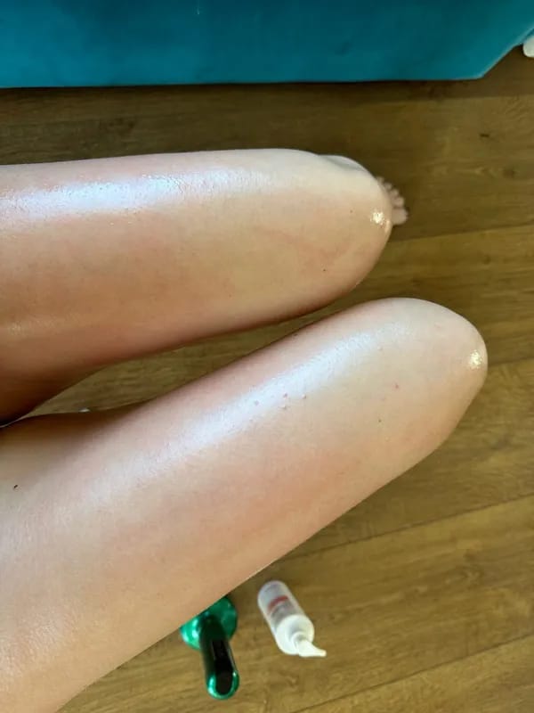 Customer photo review of Revimus Anti-Cellulite Massager