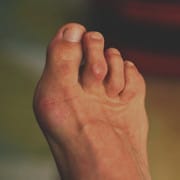 Customer photo review of 【Official Brand Store】 New Zealand Bee-Infused Joint and Bone Therapy Advanced Cream