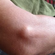 Customer photo review of 【Official Brand Store】 New Zealand Bee-Infused Joint and Bone Therapy Advanced Cream