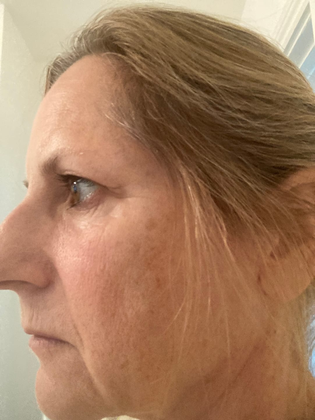 Customer photo review of Anti-Fatigue Eye Mask