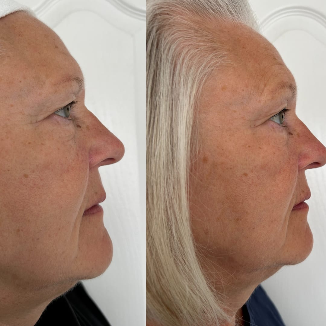 Customer photo review of Anti-Fatigue Eye Mask
