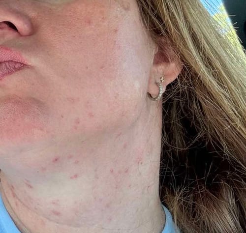 Customer photo review of Anua Heartleaf Quercetinol Pore Deep Cleansing Foam veido prausiklis