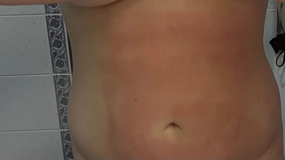 Customer photo review of Revimus Anti-Cellulite Massager