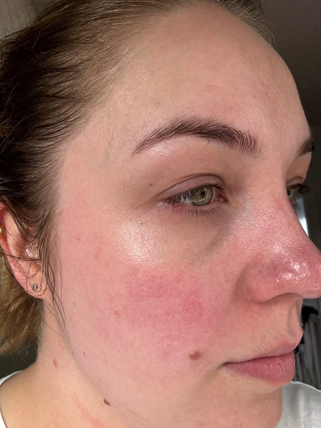 Customer photo review of Anti-Fatigue Eye Mask