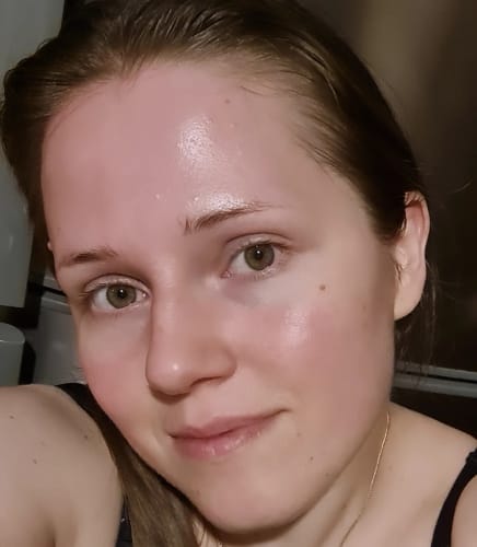 Customer photo review of AXIS-Y PHA Resurfacing Glow Peel veido pilingas