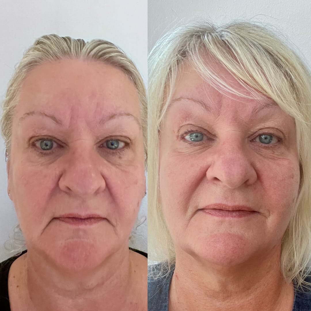 Customer photo review of Anti-Fatigue Eye Mask