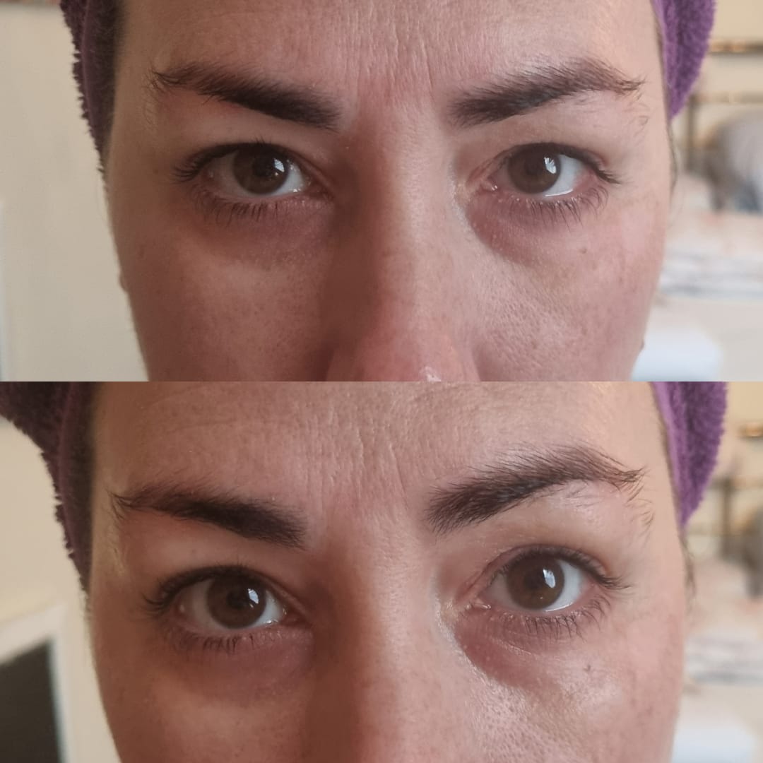 Customer photo review of Anti-Fatigue Eye Mask