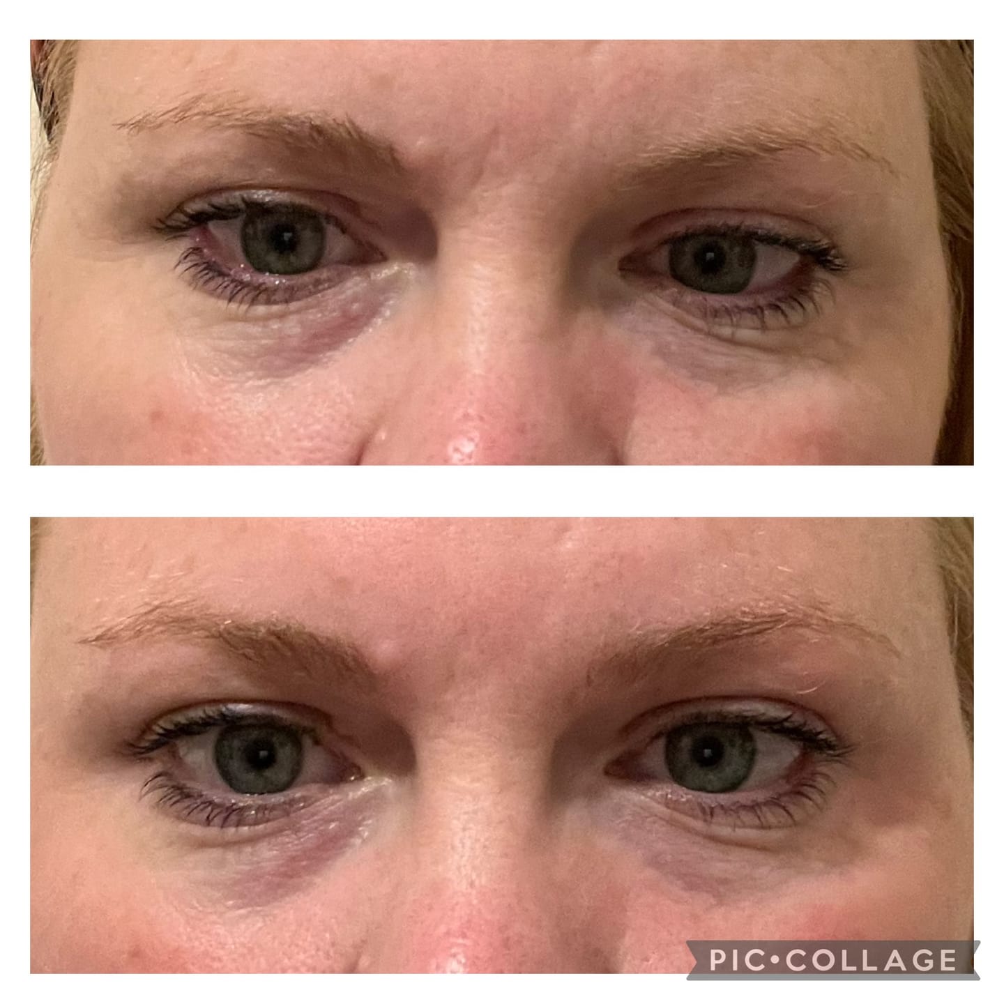 Customer photo review of Anti-Fatigue Eye Mask