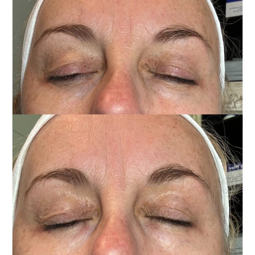 Customer photo review of Anti-Fatigue Eye Mask