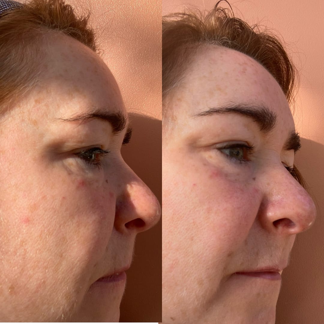 Customer photo review of Anti-Fatigue Eye Mask