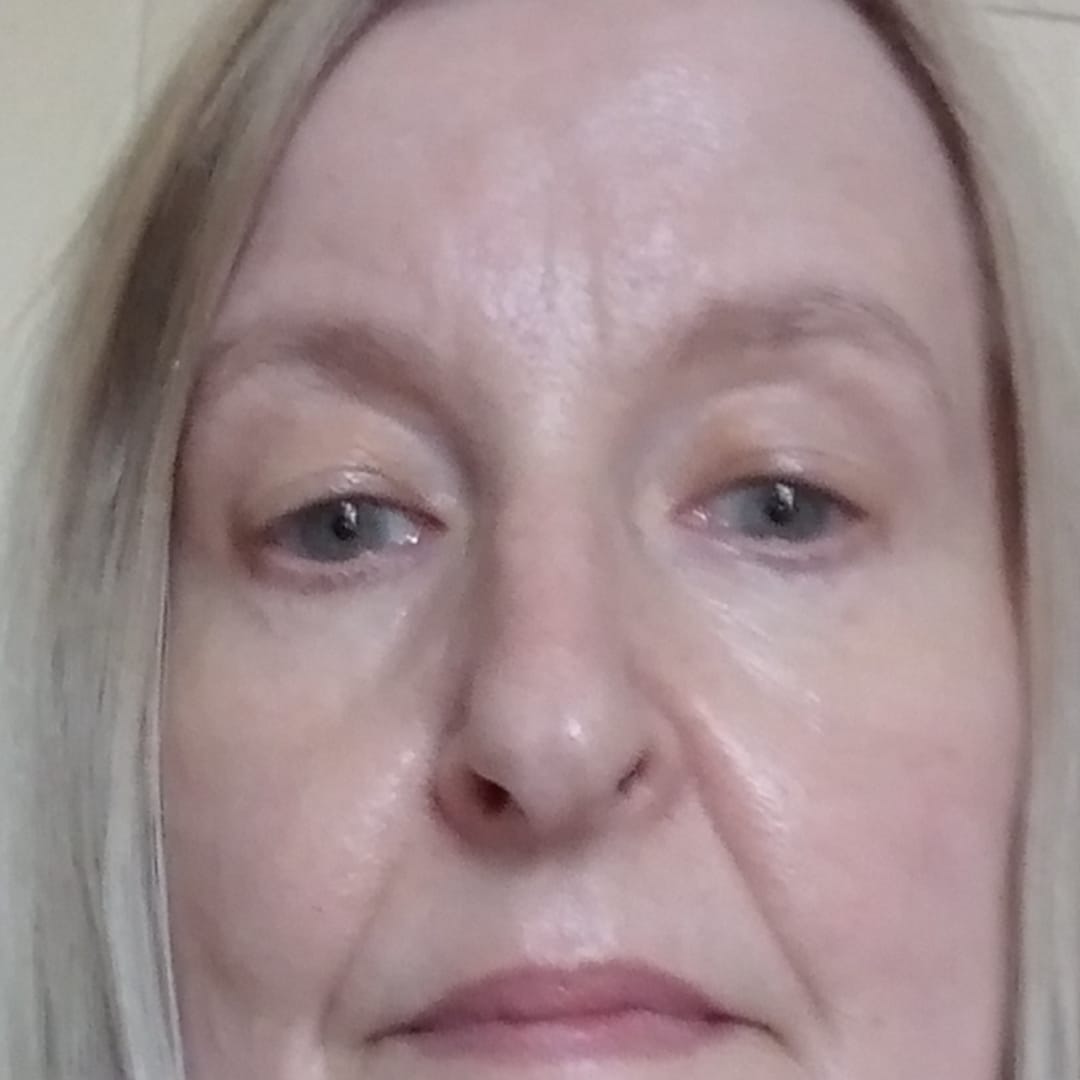 Customer photo review of Anti-Fatigue Eye Mask