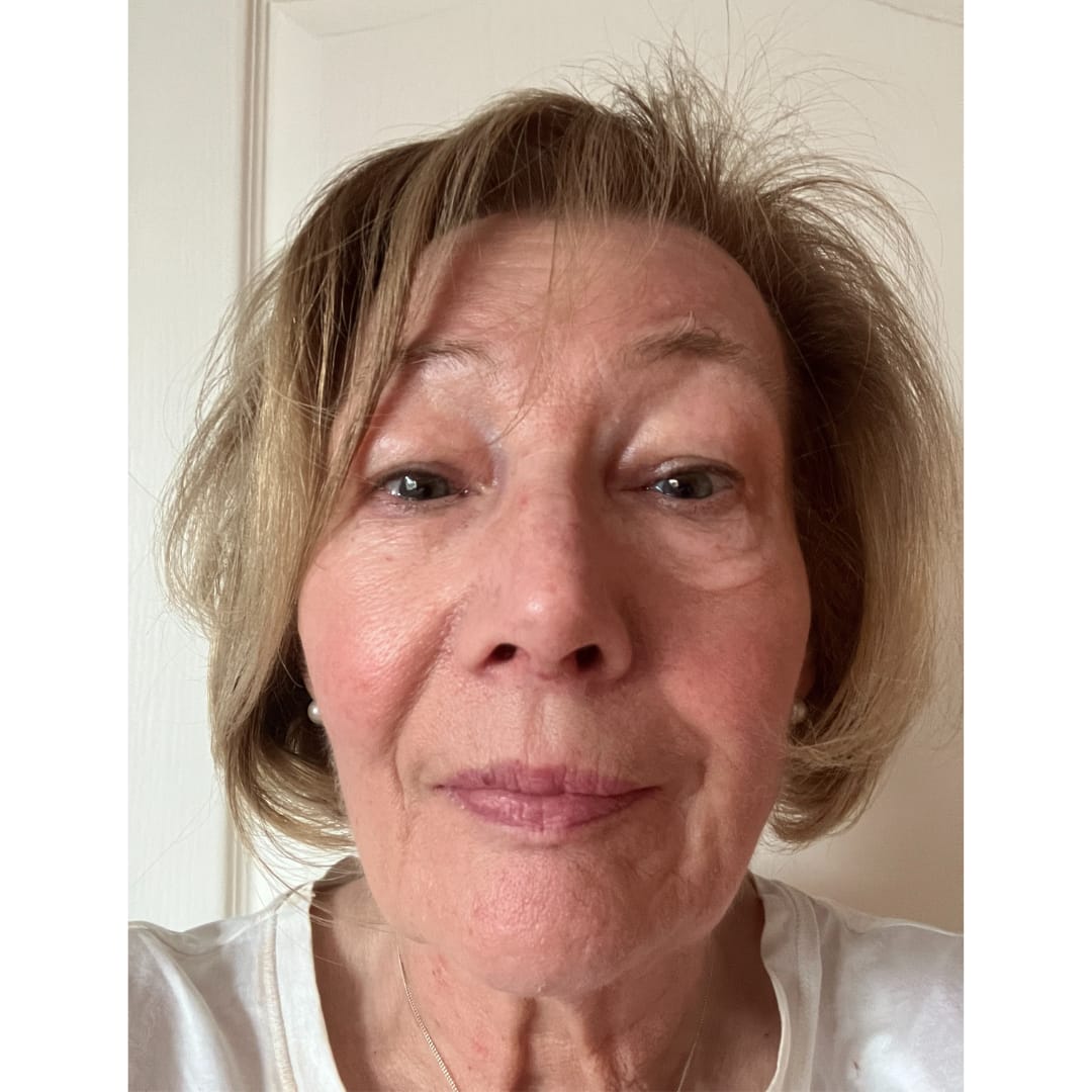 Customer photo review of Anti-Fatigue Eye Mask