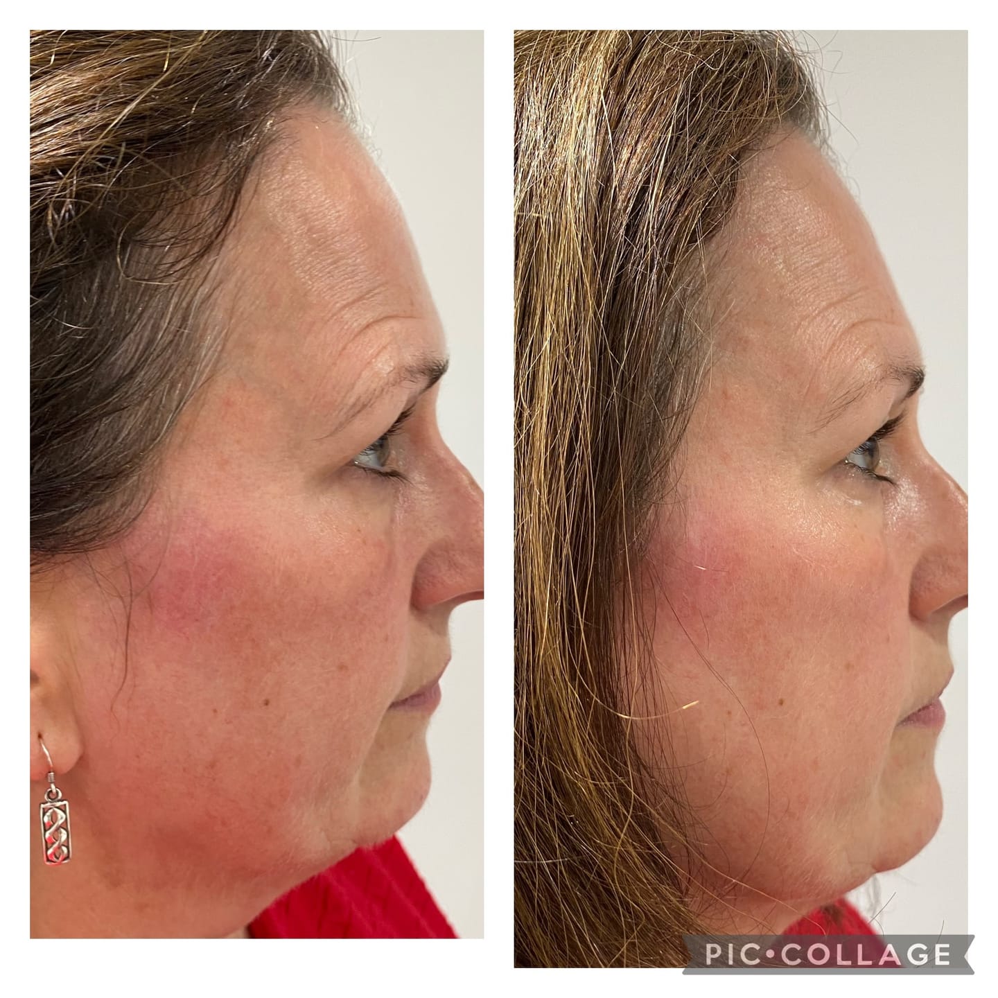 Customer photo review of Anti-Fatigue Eye Mask