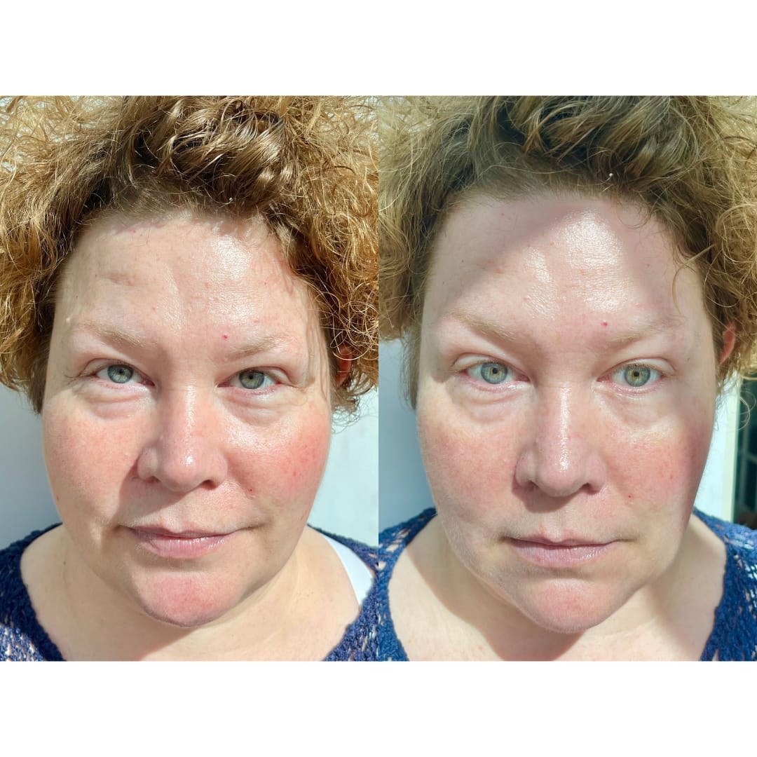 Customer photo review of Anti-Fatigue Eye Mask