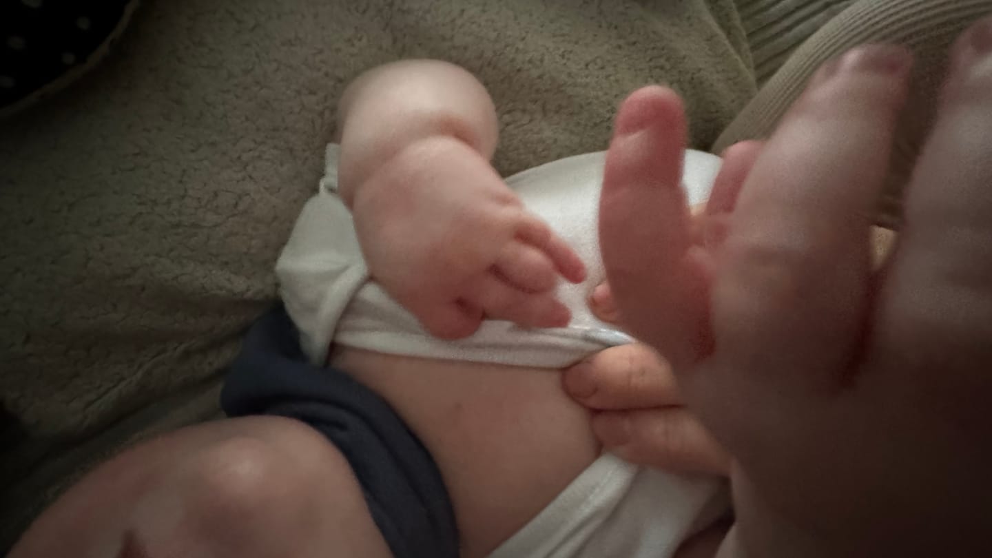 Customer photo review of Bioskin Junior Value Bundle