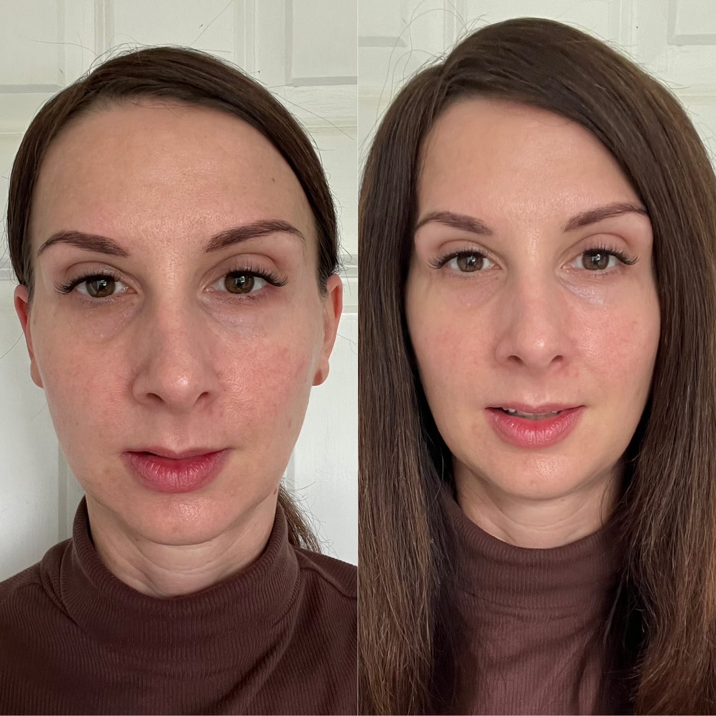 Customer photo review of Anti-Fatigue Eye Mask