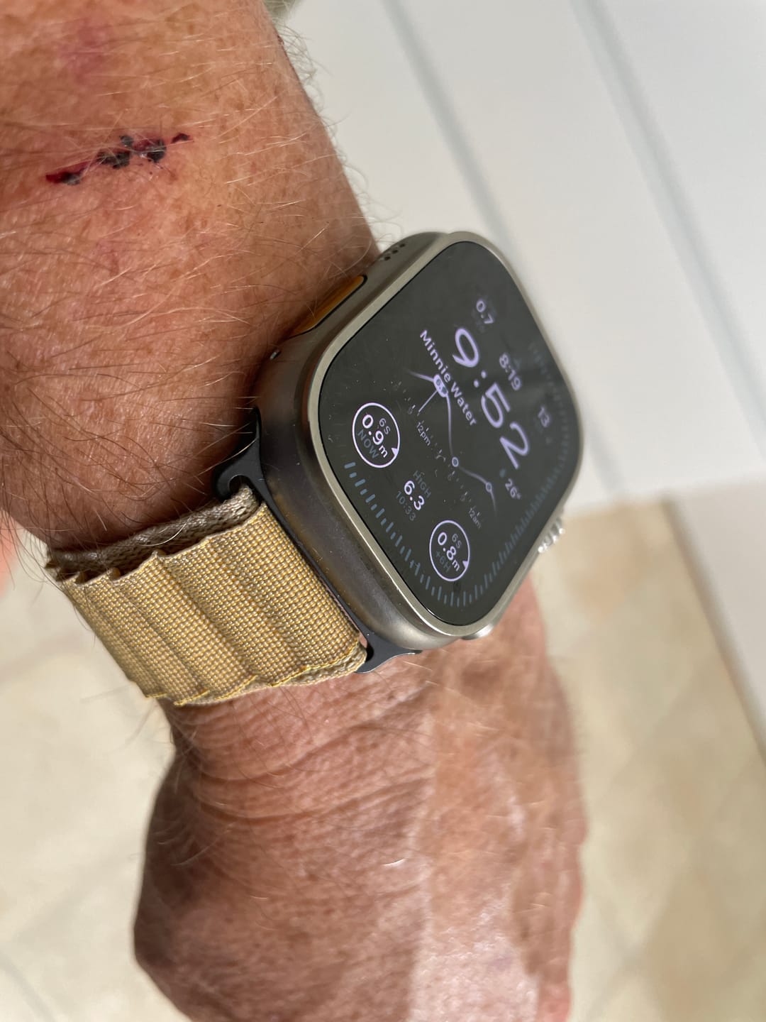 Customer photo review of Alpine Loop Apple Watch Band