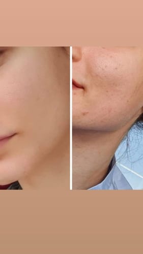 undefined review of Pigmentation Bundle: Face Wash & Melasma Cream Duo image 1 out of 1