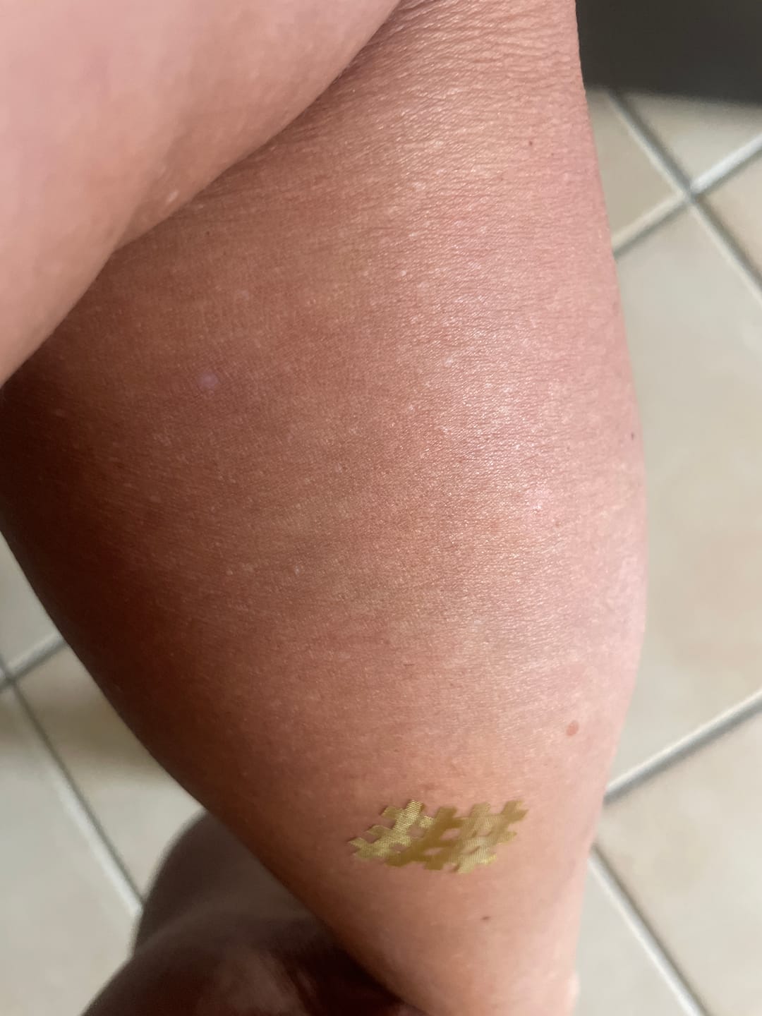 Customer photo review of Mozzigear No-Itch Patch 24's
