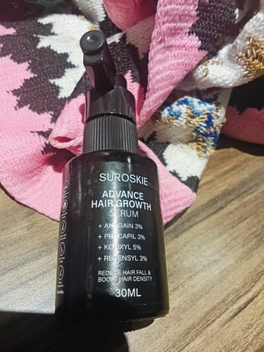 Customer photo review of Suroskie Advanced Hair Growth Serum